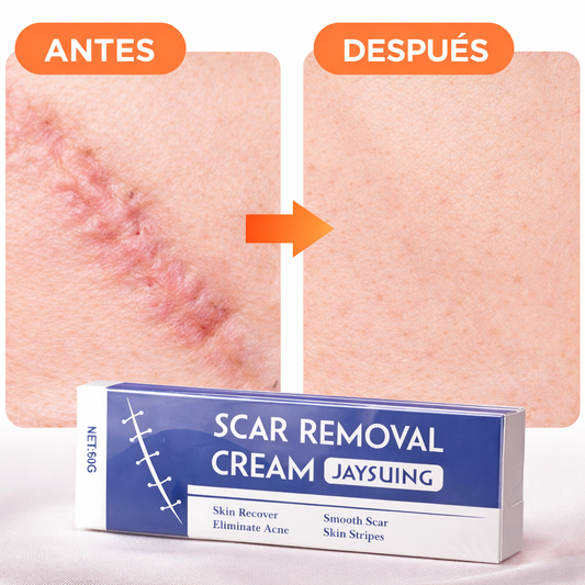 Adiós Cicatrices | Scar Removal