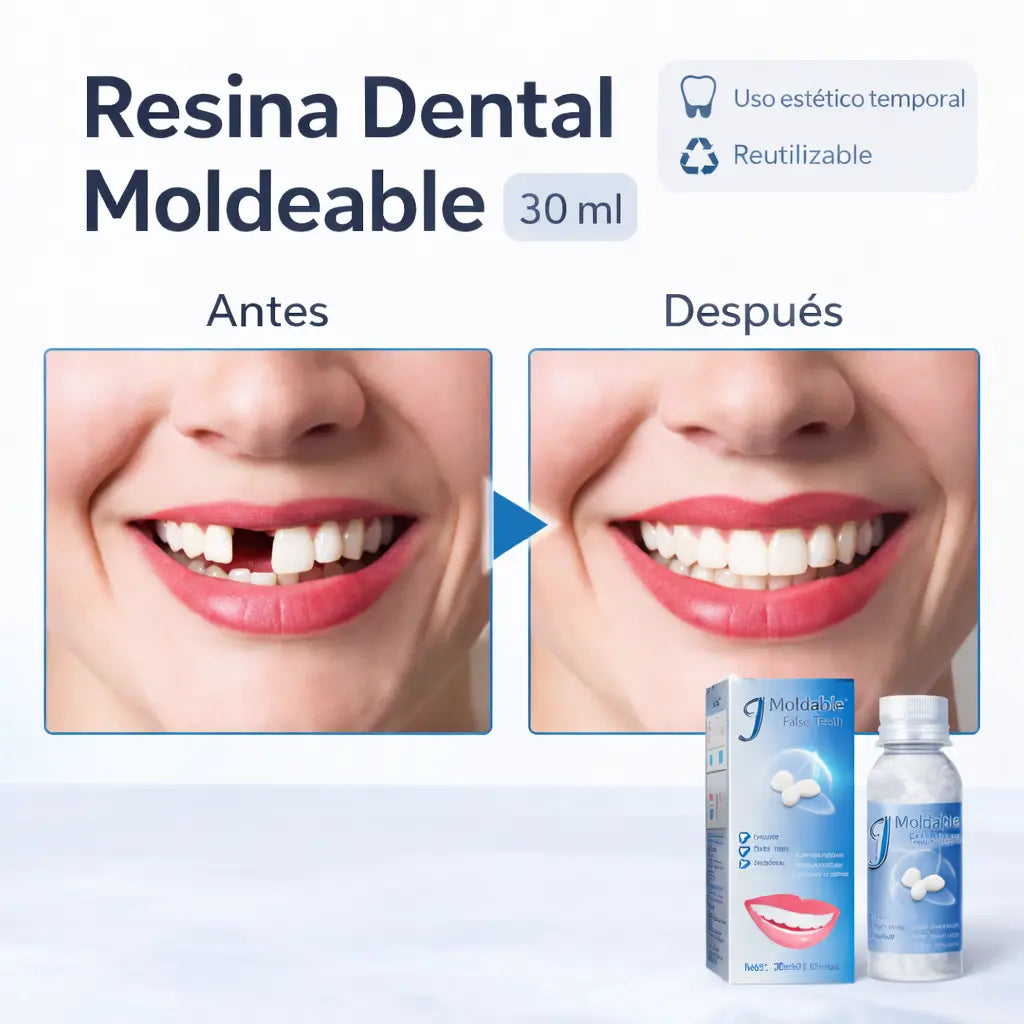 Resina Dental Moldeable – Solución Estética Temporal